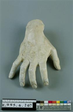 Moulage de la main droite d'Isidore Philipp | Basky, A.